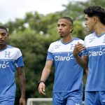 “Severo después

 – El nacional cr